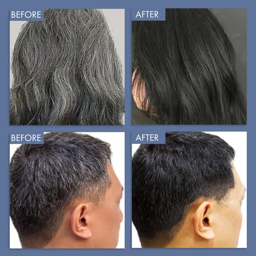 💚 Quick Hairshine Black™ -Premium Hair Color Shampoo | FLAT 45% OFF 🔥