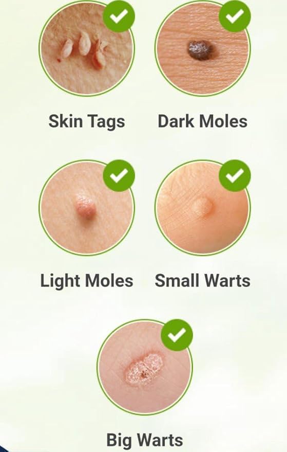🌸 Skin Tag  Remover -TagFree™ Visible Results, Beautiful Skin | FLAT 45% OFF 🔥