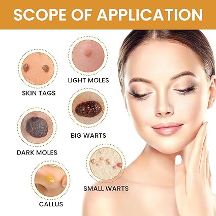 🌸 Skin Tag  Remover -TagFree™ Visible Results, Beautiful Skin | FLAT 45% OFF 🔥