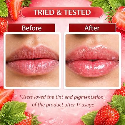 💋 PinkAura™ Lip Brightening Cream 💎| (Pack Of 2) 🔥