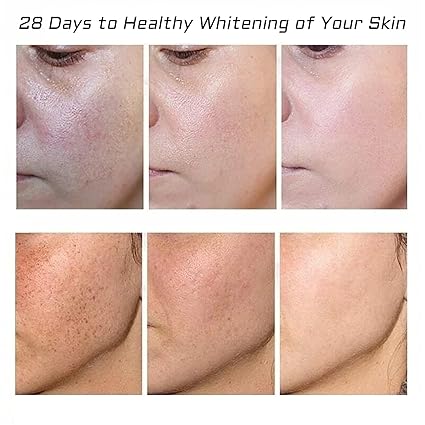 🌸 Skin Tag  Remover -TagFree™ Visible Results, Beautiful Skin | FLAT 45% OFF 🔥