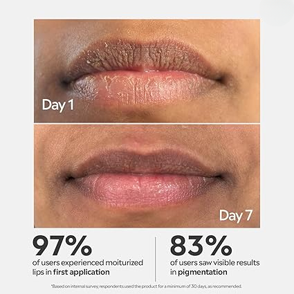 💋 PinkAura™ Lip Brightening Cream 💎| (Pack Of 2) 🔥